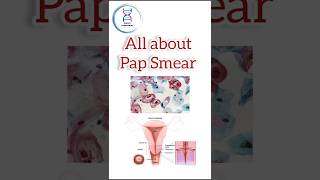 Pap Smear Test for early detection of cervical cancer cervical cervicalcancer papsmera papsmear [upl. by Tupler]