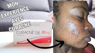 traitement médicamenteux de lacné sévère curacné 200mg [upl. by Stafani]