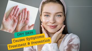 Dry Skin Types Risk Factors and Treatments [upl. by Annatnom245]