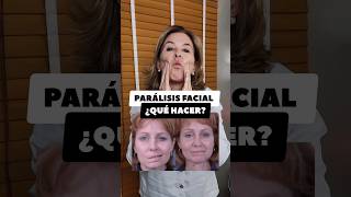 PARALISIS FACIAL ¿QUÉ HACER [upl. by Eelarual981]