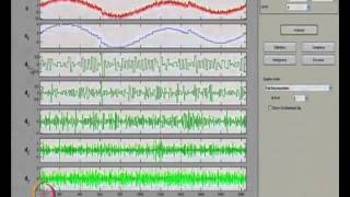 Mod01 Lec50 Wavelet Applications [upl. by Kerin]