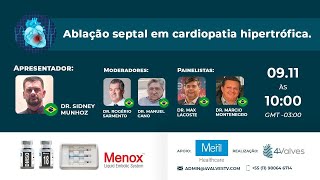 Ablação Septal em Cardiopatia Hipertrófica [upl. by Ylremik]