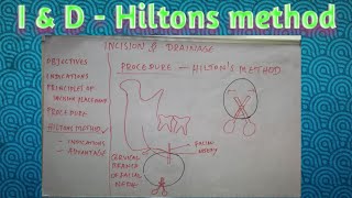 Incision and drainage  hiltons method of abscess drainage [upl. by Amlas]