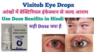 Visitob Eye Drops Use in Hindi आंखों के हर प्रकार की समस्या से तुरन्त आराम eyes drops antibiotic [upl. by Dorej]