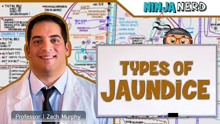 Gastrointestinal  Types of Jaundice [upl. by Ainoet]