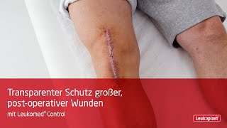 Wie man große postoperative Wunden transparent mit Leukomed Control schützt [upl. by Reffinnej]