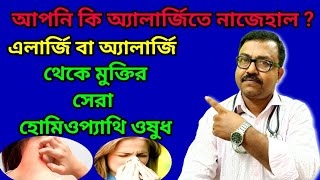 এলার্জি বা অ্যালার্জি থেকে মুক্তির সেরা হোমিওপ্যাথি ওষুধ  Homeopathic Medicine [upl. by Zaccaria]