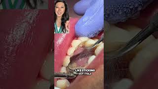 Sometimes conservativeminimally invasive dentistry is a better option [upl. by Amrita]