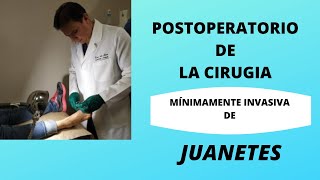 JUANETES EN LOS PIES CIRUGÍA MÍNIMA POSTOPERATORIO [upl. by Naehs]