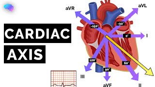 Cardiac Axis Explained  ECG  EKG  OSCE Guide  UKMLA  CPSA [upl. by Cristabel675]