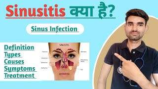 Sinusitis in Hindi  Causes Symptoms and Treatment of Sinusitis [upl. by Marris302]