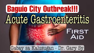 Acute Gastroenteritis  Dr Gary Sy [upl. by Attalie953]