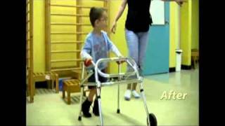 Cerebral Palsy Therapy  Malek 3 years old [upl. by Eelidnarb508]