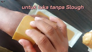 DuoDerm Extra Thin Apakah Bisa Untuk Luka Ca mamae  RaFer QnA [upl. by Longerich]