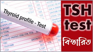 Tsh test report bangla  থাইরয়েড হরমোন টেস্ট খরচ কতো [upl. by Mungo]