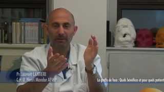 FT LAURENT LANTIERI La greffe de faceFACE TRANSPLANT FRANCE [upl. by Hailat634]