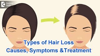 Types of Hair Loss  Common Causes Symptoms amp Treatment  Dr Kavitha GV Mandal [upl. by Shurwood]