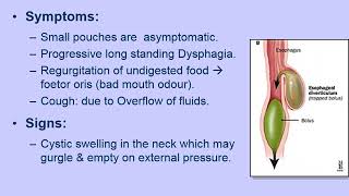 Pharyngology P4 pharyngeal pouch [upl. by Ahsias]