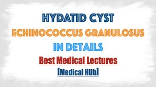 Hydatid cyst of Echinococcus granulosusDog tapeworm  Discussed in details everything you need [upl. by Tilda970]