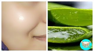 ✔️ Cómo hacer una mascarilla facial con sabila [upl. by Eulalee]