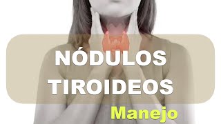 Nódulos en la tiroides síntomas tipos y tratamiento [upl. by Nichy542]