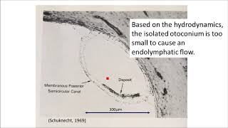 The etiology of BPPV microotoconia accumulation theory [upl. by Ecinert]