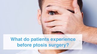 What do patients experience before ptosis surgery [upl. by Lubow934]