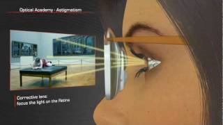 Shamir Optical Academy Astigmatism [upl. by Tengdin]