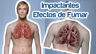 Imágenes a Diario quotLos Impactantes Efectos de Fumarquot [upl. by Ettelra]