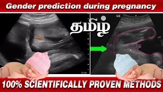 Gender prediction during pregnancy in Tamil  100 Scientific Proven Method  Nithya Arunkumar [upl. by Daht988]