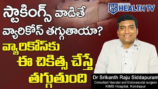 Will Varicose Veins Decrease If Stockings Are Used స్టాకింగ్స్ వాడితే వ్యారికోస్ తగ్గుతాయా [upl. by Burgess]