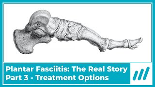 Plantar Fasciitis Part 3 Treatment Options [upl. by Lud710]