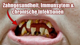 Zahngesundheit amp Immunsystem  Dr Karin BenderGonser  Chronische Infektionen Kongress [upl. by Sorce]