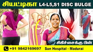 L4L5S1 DISC BULGE  FOOT NUMBNESS  Physiotherapy Treatment  RECOVERY  Sun Hospital Madurai [upl. by Thurmond55]