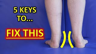 The 5 KEYS To Improve Flat Feet Fallen Arches amp Foot Overpronation [upl. by Goer]