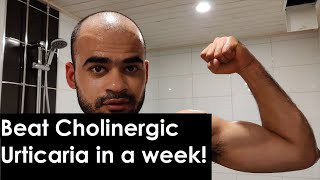 Beat CHOLINERGIC URTICARIA in a WEEK [upl. by Lyreb]