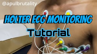 Holter ECG monitoring tutorial  placement recording and interpretation [upl. by Tedric]