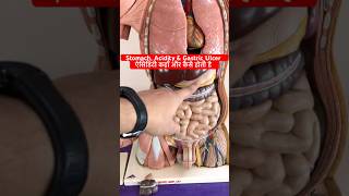 Acidity Gastric Ulcer Peptic Ulcer amp Stomach ऐसिडिटी एवं पेट के छाले कहाँ और कैसे बनते है shorts [upl. by Nareht998]