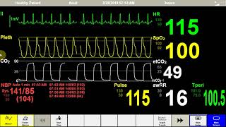 MH Vitals [upl. by Dorahs]