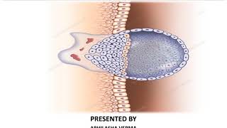 How long does heavy implantation bleeding last [upl. by Adnawaj191]