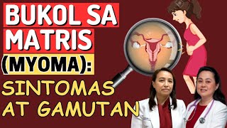 BUKOL sa MATRIS Myoma  Sintomas at Gamutan  By Doc Liza RamosoOng [upl. by Dijam]