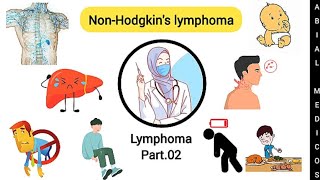 NonHodgkins lymphoma  Part02  Sign and symptoms  Diagnosis  Treatment  lymphoma [upl. by Yelich]