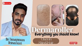 Dermaroller treatment  Dermaroller for hair growth  Dermaroller for acne scars dermaroller [upl. by Jedlicka875]