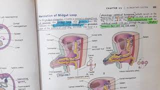 Mid gut Development and Rotation  Alimentary System Part 7 [upl. by Ulda]