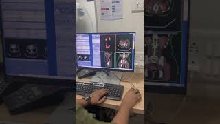 3D reconstruction ct Urography ctscan ctscantechnician trendingshorts tyshorts shortvideo [upl. by Glaudia]