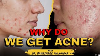 Clear amp Spotless Skin Tips  How to treat Pimples amp Acne [upl. by Terle585]