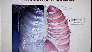 Anatomy of Intercostal Muscles [upl. by Anisor]