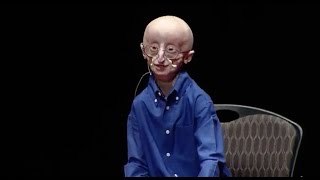 My philosophy for a happy life  Sam Berns  TEDxMidAtlantic [upl. by Aneehs]