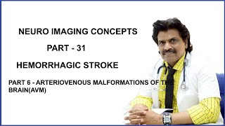 NEUROIMAGING CONCEPTS PART31PART 6HEMORRHAGIC STROKE ARTERIOVENOUS MALFORMATION OFTHE BRAINAVM [upl. by Junna]