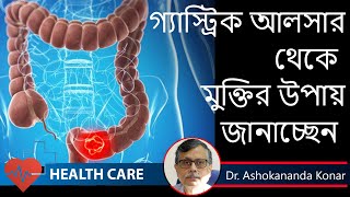 Peptic Ulcer Symptoms  কোন লক্ষণ গুলি হলে বুঝবেন গ্যাস্ট্রিক আলসার হয়েছে  Dr Ashokananda Konar [upl. by Ogaitnas343]